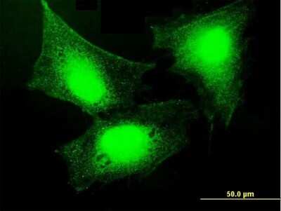 Immunocytochemistry/Immunofluorescence: GBP5 Antibody [H00115362-B02P] - Analysis of purified antibody to GBP5 on HeLa cell. (antibody concentration 10 ug/ml)