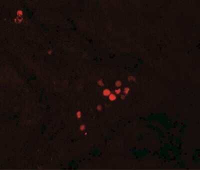 Immunohistochemistry: GBP5 Antibody [NBP2-81821] - Immunofluorescence of GBP5 in human liver tissue with GBP5 antibody at 20 ug/ml.