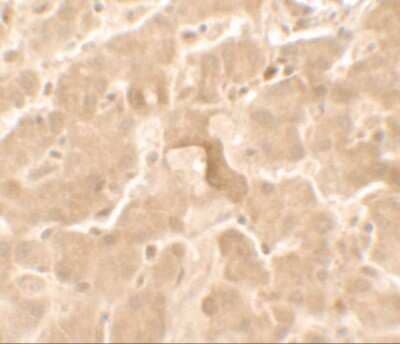 Immunohistochemistry: GBP5 Antibody [NBP2-81821] - Immunohistochemistry of GBP5 in human liver tissue with GBP5 antibody at 2.5 ug/ml.