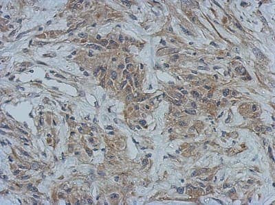 <b>Biological Strategies Validation. </b>Immunohistochemistry-Paraffin: GBP5 Antibody [NBP2-16620] - Immunohistochemical analysis of paraffin-embedded U373 xenograft, using antibody at 1:500 dilution.