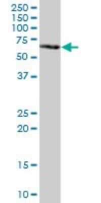 Western Blot: GBP5 Antibody [H00115362-B01P] - Analysis of GBP5 expression in human liver.