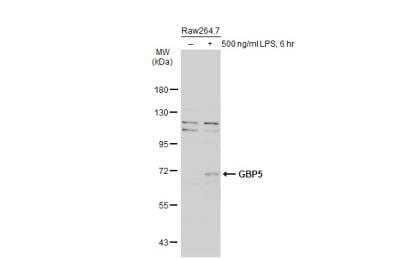 Western Blot: GBP5 Antibody [NBP1-32520] - Untreated (-) and treated (+) Raw264.7 whole cell extracts (30 ug) were separated by 7.5% SDS-PAGE, and the membrane was blotted with GBP5 antibody [N1N3] diluted at 1:500. The HRP-conjugated anti-rabbit IgG antibody was used to detect the primary antibody, and the signal was developed with Trident ECL plus-Enhanced.