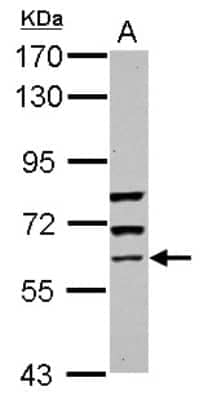 Western Blot: GBP5 Antibody [NBP2-16620] - Sample (30 ug of whole cell lysate) A: HeLa 7. 5% SDS PAGE gel, diluted at 1:2000.