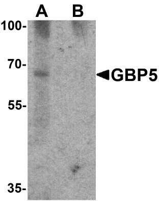 Western Blot: GBP5 Antibody [NBP2-81821] - Western blot analysis of GBP5 in rat liver tissue lysate with GBP5 antibody at 1 ug/mL in (A) the absence and (B) the presence of blocking peptide.