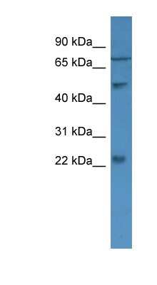 Western Blot: GCAP2 Antibody [NBP1-79774] - U937 cell lysate, concentration 0.2-1 ug/ml.