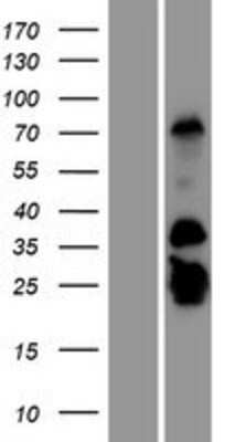 Western Blot: GCAP2 Overexpression Lysate (Adult Normal) [NBP2-10804] Left-Empty vector transfected control cell lysate (HEK293 cell lysate); Right -Over-expression Lysate for GCAP2.