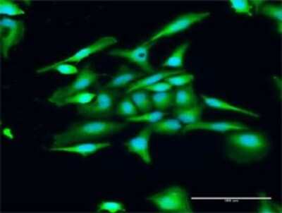Immunocytochemistry/Immunofluorescence: GCAP3 Antibody [H00009626-D01P] - Analysis of antibody to GUCA1C on HeLa cell. Antibody concentration 20 ug/ml.