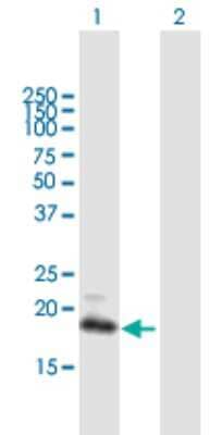 Western Blot: GCAP3 Antibody [H00009626-B01P] - Analysis of GUCA1C expression in transfected 293T cell line by GUCA1C polyclonal antibody.  Lane 1: GUCA1C transfected lysate(22.99 KDa). Lane 2: Non-transfected lysate.