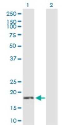 Western Blot GCAP3 Antibody