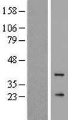 Western Blot GCAP3 Overexpression Lysate