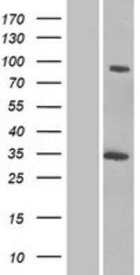 Western Blot: GCC1 Overexpression Lysate (Adult Normal) [NBP2-06329] Left-Empty vector transfected control cell lysate (HEK293 cell lysate); Right -Over-expression Lysate for GCC1.