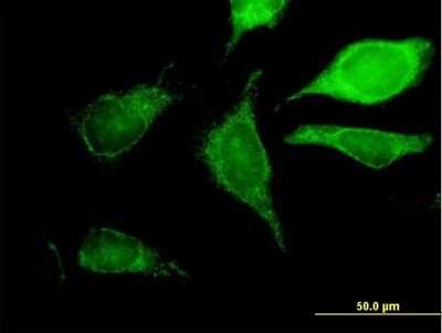 Immunocytochemistry/Immunofluorescence: GCDH Antibody [H00002639-B01P] - Analysis of purified antibody to GCDH on HeLa cell. (antibody concentration 10 ug/ml)