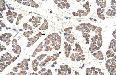 Immunohistochemistry-Paraffin: GCDH Antibody [NBP1-54737] - Human Muscle Tissue, Skeletal muscle cells (Indicated with Arrows) 4-8ug/ml.