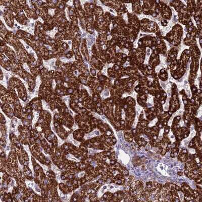 Immunohistochemistry-Paraffin: GCDH Antibody [NBP2-48907] - Staining of human liver shows strong positivity in mitochondria in hepatocytes.