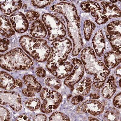 Immunohistochemistry-Paraffin: GCDH Antibody [NBP2-48907] - Staining of human kidney shows moderate to strong positivity in mitochondria in cells in tubules.