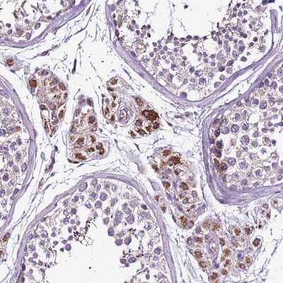 Immunohistochemistry-Paraffin: GCDH Antibody [NBP2-48907] - Staining of human testis shows moderate to strong positivity in mitochondria in Leydig cells.