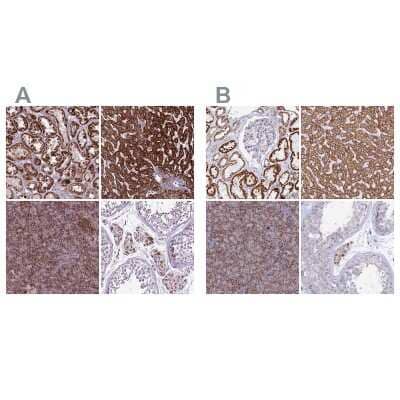 <b>Independent Antibodies Validation and Orthogonal Strategies Validation.</b>Immunohistochemistry-Paraffin: GCDH Antibody [NBP2-48907] - Staining of human kidney, liver, pancreas and testis using Anti-GCDH antibody NBP2-48907 (A) shows similar protein distribution across tissues to independent antibody NBP2-48549 (B).