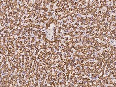Immunohistochemistry-Paraffin: GCDH Antibody [NBP2-98593] - Immunochemical staining of human GCDH in human liver with rabbit polyclonal antibody at 1:100 dilution, formalin-fixed paraffin embedded sections.