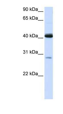 Western Blot: GCDH Antibody [NBP1-54641] - 293T cells lysate, concentration 0.2-1 ug/ml.