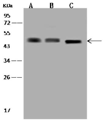 Western Blot: GCDH Antibody [NBP2-98593] - Anti-GCDH rabbit polyclonal antibody at 1:500 dilution. Lane A: HepG2 Whole Cell Lysate Lane B: K562 Whole Cell Lysate Lane C: U-251 MG Whole Cell Lysate Lysates/proteins at 30 ug per lane. Secondary Goat Anti-Rabbit IgG (H+L)/HRP at 1/10000 dilution. Developed using the ECL technique. Performed under reducing conditions. Predicted band size: 48 kDa. Observed band size: 48 kDa