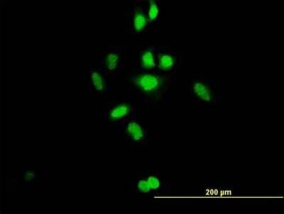 Immunocytochemistry/Immunofluorescence: GCFC1 Antibody [H00094104-B01P] - Analysis of purified antibody to C21orf66 on HeLa cell. (antibody concentration 10 ug/ml)
