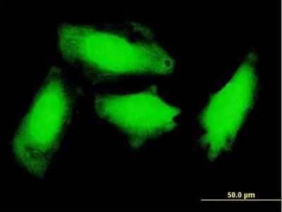 Immunocytochemistry/Immunofluorescence: GCH1 Antibody (1F5) [H00002643-M03] - Analysis of monoclonal antibody to GCH1 on HeLa cell. Antibody concentration 10 ug/ml