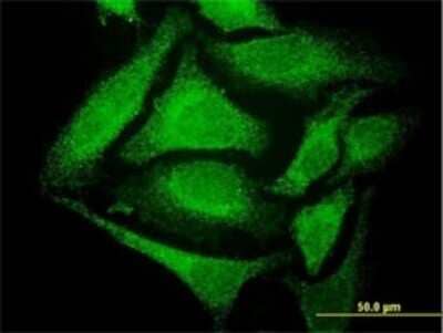 Immunocytochemistry/Immunofluorescence: GCH1 Antibody (2C4) [H00002643-M02] - Analysis of monoclonal antibody to GCH1 on HeLa cell . Antibody concentration 10 ug/ml.