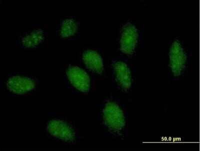 Immunocytochemistry/Immunofluorescence: GCH1 Antibody [H00002643-B01P] - Analysis of purified antibody to GCH1 on HeLa cell. (antibody concentration 10 ug/ml)