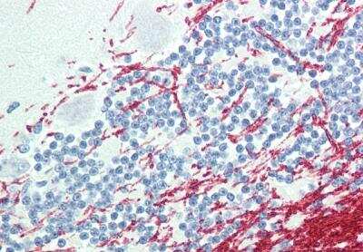 Immunohistochemistry GCH1 Antibody