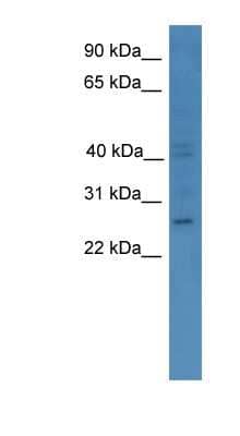 Western Blot: GCH1 Antibody [NBP1-79771] - COLO205 cells lysate, concentration 0.2-1 ug/ml.