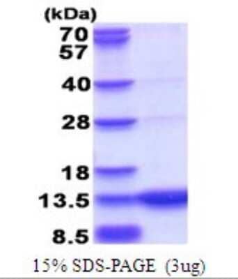 SDS-PAGE Recombinant Human GCHFR His Protein