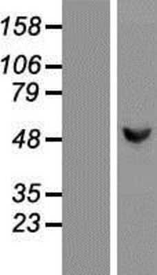 Western Blot: GCK Overexpression Lysate (Adult Normal) [NBP2-05877] Left-Empty vector transfected control cell lysate (HEK293 cell lysate); Right -Over-expression Lysate for GCK.