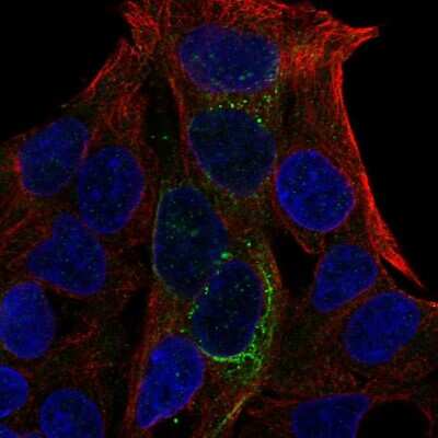 Immunocytochemistry/Immunofluorescence: GCKR Antibody [NBP2-56132] - Staining of human cell line Hep G2 shows localization to intermediate filaments.