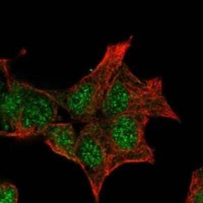 Immunocytochemistry/Immunofluorescence: GCKR Antibody [NBP3-17855] - Staining of human cell line Hep G2 shows localization to nucleoplasm & cytosol.