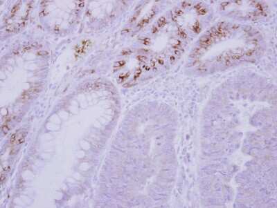 Immunohistochemistry-Paraffin: GCKR Antibody [NBP2-16623] -  Human normal colon, using GCKR antibody at 1:500 dilution. Antigen Retrieval: Trilogy™ (EDTA based, pH 8.0) buffer, 15min. 