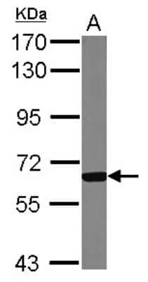 Western Blot: GCKR Antibody [NBP2-16623] - Sample (50 ug of whole cell lysate) A: Mouse Liver, 7. 5% SDS PAGE gel, diluted at 1:1000.