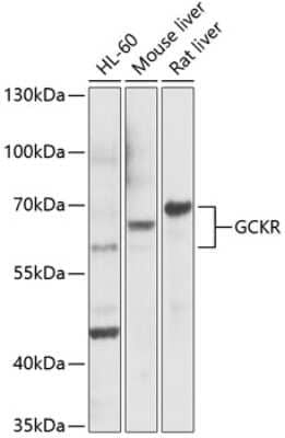 Western Blot: GCKR Antibody [NBP3-04639] - Analysis of extracts of various cell lines, using GCKR antibody at 1:1000 dilution. Secondary antibody: HRP Goat Anti-Rabbit IgG (H+L) at 1:10000 dilution. Lysates/proteins: 25ug per lane. Blocking buffer: 3% nonfat dry milk in TBST. Detection: ECL Basic Kit