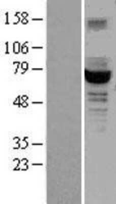 Western Blot: GCKR Overexpression Lysate (Adult Normal) [NBL1-11010] Left-Empty vector transfected control cell lysate (HEK293 cell lysate); Right -Over-expression Lysate for GCKR.