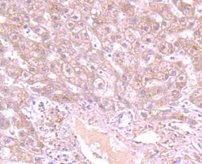 Immunohistochemistry-Paraffin: GCLC Antibody (JA08-03) [NBP2-66864] - Analysis of paraffin-embedded human fetal liver tissue using anti-GCLC antibody. Counter stained with hematoxylin.