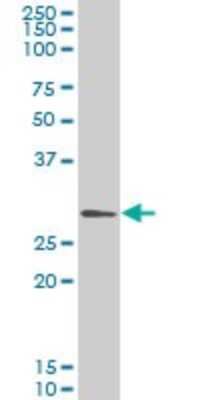 Western Blot: GCLM Antibody (2B8) [H00002730-M01] - GCLM monoclonal antibody (M01), clone 2B8 Analysis of GCLM expression in HeLa.