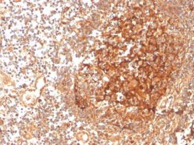 Immunohistochemistry-Paraffin: GCLM Antibody (CPTC-GCLM-1) - Azide and BSA Free [NBP3-08471] - Formalin-fixed, paraffin-embedded human tonsil stained with GCLM Mouse Monoclonal Antibody (CPTC-GCLM-1).