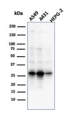 Western Blot: GCLM Antibody (CPTC-GCLM-1) - Azide and BSA Free [NBP3-08471] - Western Blot Analysis of A549, A431 & HepG2 cell lysates using GCLM Mouse Monoclonal Antibody (CPTC-GCLM-1).