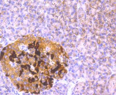Immunohistochemistry-Paraffin: GCLM Antibody (JM93-61) [NBP2-75502] - Analysis of paraffin-embedded human pancreas tissue using anti-GCLM antibody. Counter stained with hematoxylin.