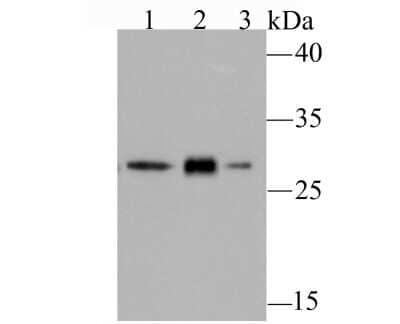 Western Blot: GCLM Antibody (JM93-61) [NBP2-75502] - Analysis of GCLM on different cell lysates using anti-GCLM antibody at 1/500 dilution.Positive control:Lane 1: A431         Lane 2: PC-12Lane 3: NIH-3T3