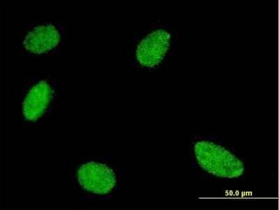 Immunocytochemistry/Immunofluorescence: GCM1 Antibody (3G7) [H00008521-M03] - Analysis of monoclonal antibody to GCM1 on HeLa cell. Antibody concentration 10 ug/ml