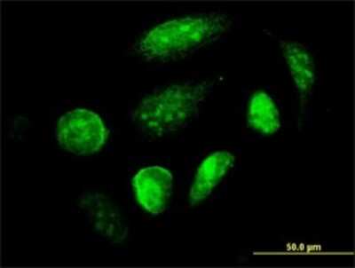 Immunocytochemistry/Immunofluorescence: GCM1 Antibody (4E8) [H00008521-M04] - Analysis of monoclonal antibody to GCM1 on HeLa cell. Antibody concentration 10 ug/ml