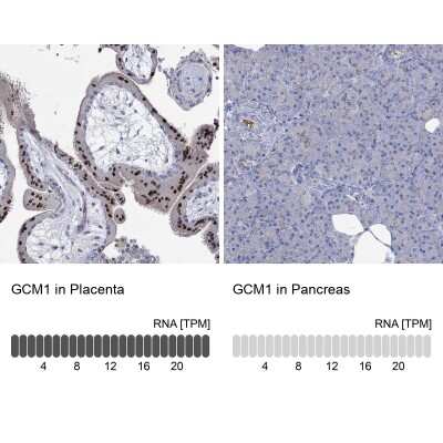 Immunohistochemistry-Paraffin: GCM1 Antibody [NBP3-17006] - Analysis in human placenta and pancreas tissues using Anti-GCM1 antibody. Corresponding GCM1 RNA-seq data are presented for the same tissues.