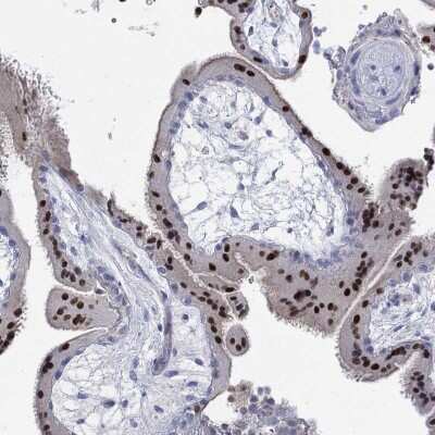 Immunohistochemistry-Paraffin: GCM1 Antibody [NBP3-17006] - Staining of human placenta shows high expression.