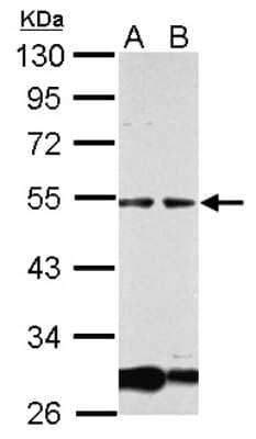 Western Blot: GCM1 Antibody [NBP2-14966] - Sample (30 ug of whole cell lysate) A: HepG2 B: HepG2 nucleus 10% SDS PAGE; antibody diluted at 1:1000.