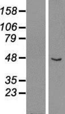 Western Blot: GCM1 Overexpression Lysate (Adult Normal) [NBP2-07969] Left-Empty vector transfected control cell lysate (HEK293 cell lysate); Right -Over-expression Lysate for GCM1.